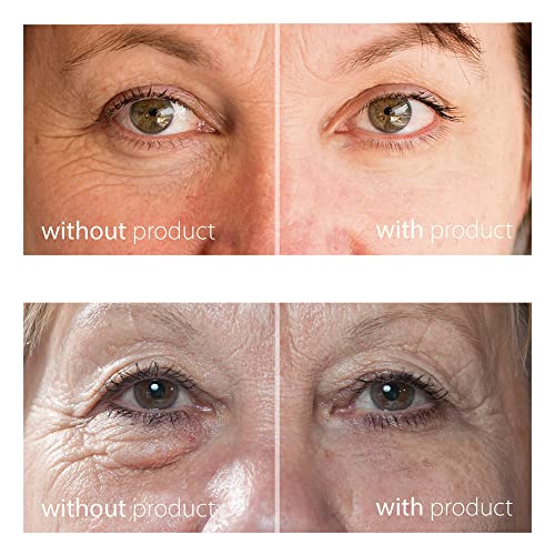 My Perfect Eyes Anti-Aging Eye Cream, 100 Uses