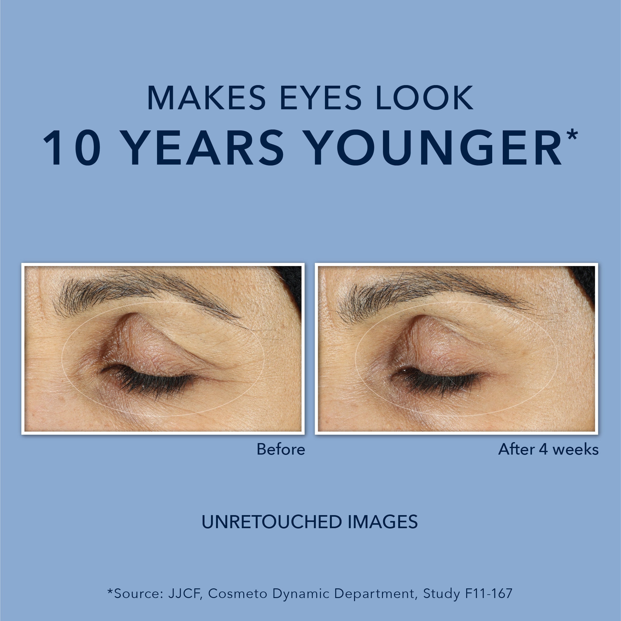 Roc Retinol Eye Cream for Dark Circles & Puffiness