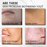 ViLaViDe Organic Triangle Exfoliator for Radiant Skin