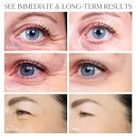 VELAMO Retinol Eye Stick for Dark Circles & Puffiness