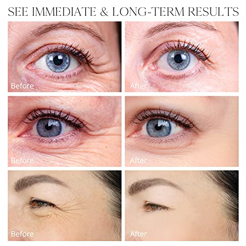 VELAMO Retinol Eye Stick for Dark Circles & Puffiness