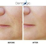 Dermlogic Anti-Aging Peel Pads with Exfoliating Ingredients