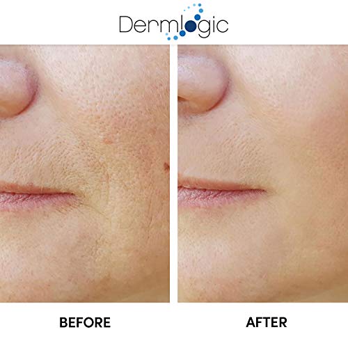 Dermlogic Anti-Aging Peel Pads with Exfoliating Ingredients