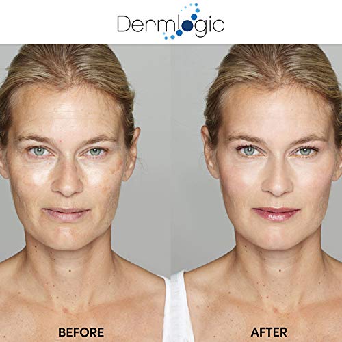 Dermlogic Anti-Aging Peel Pads with Exfoliating Ingredients