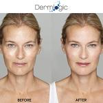Dermlogic Anti-Aging Peel Pads with Exfoliating Ingredients