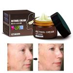 Retinol Anti-Wrinkle Cream for Face and Neck