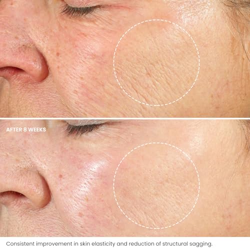 Hyaluronic Acid Anti-Aging Cream with Retinol