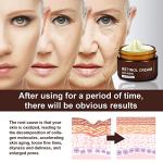 Retinol Anti-Wrinkle Cream for Face and Neck