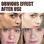 Retinol Anti-Wrinkle Cream for Face and Neck