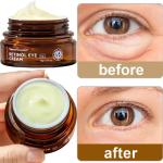 Retinol Eye Cream for Dark Circles and Puffiness
