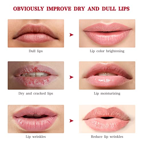 20pcs Lip Plumping Gel Pads for Hydration