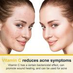 Vitamin C Hydrating Anti-Aging Cream for Face