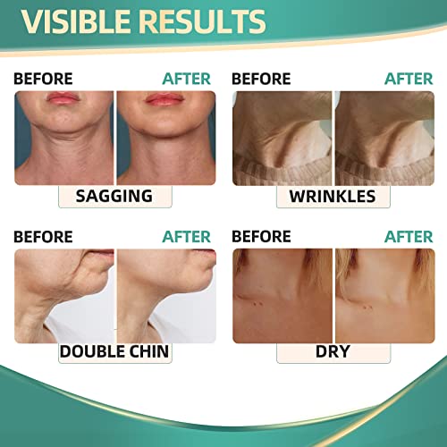 Neck Firming Cream with Retinol and Hyaluronic Acid