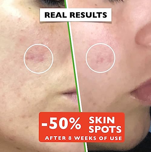 Organic Vitamin C Serum with Hyaluronic Acid & Niacinamide