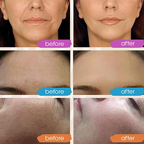 Retinol and Vitamin C Glow Face Serum