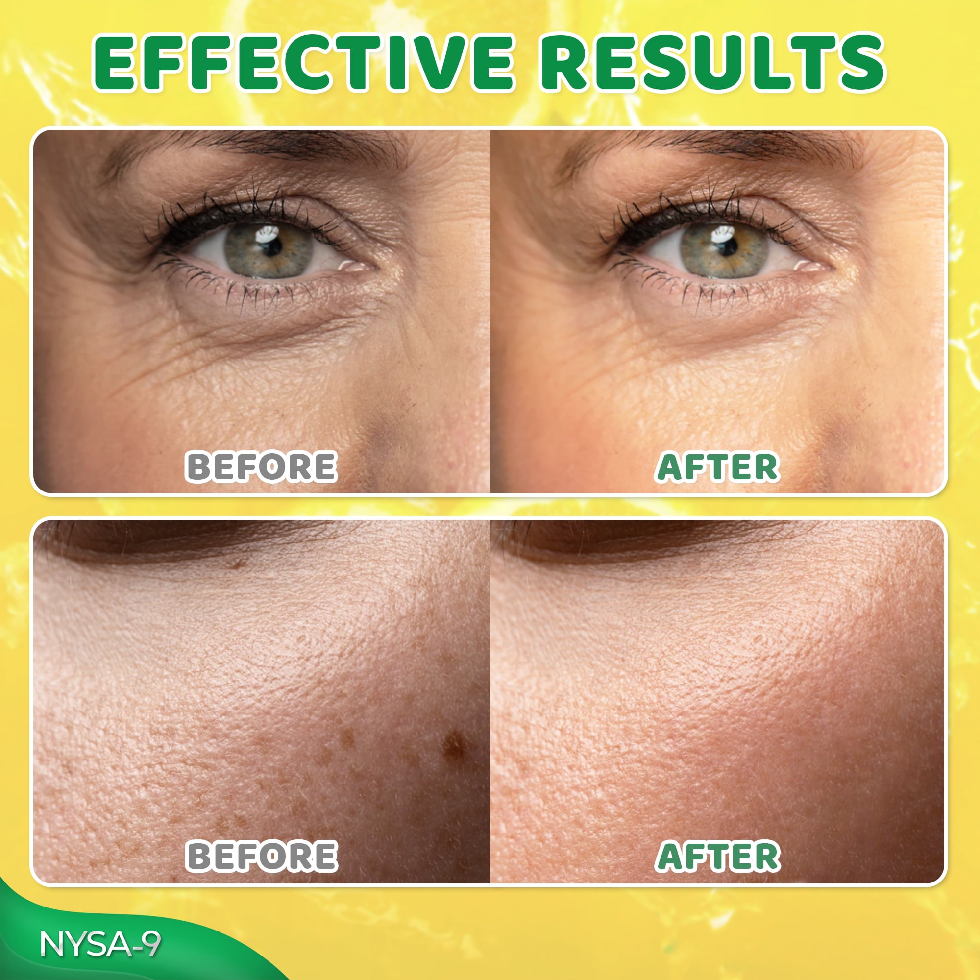 Nysa-9 Vitamin C Serum Duo for Radiant Skin