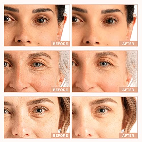 2.5% Retinol Face Serum with Vitamin C & B5