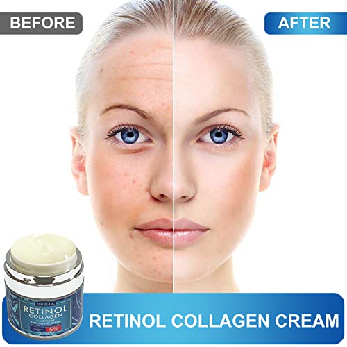 Retinol Anti-Aging Moisturizer with Collagen and Hyaluronic Acid