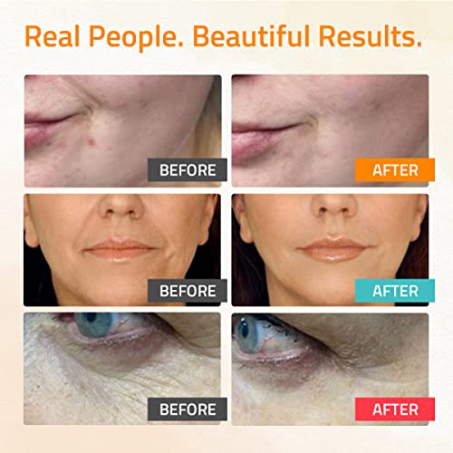 YEOUTH Retinol & Vitamin C Anti-Aging Serum