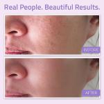 YEOUTH Hydrating Face Toner for Youthful Skin