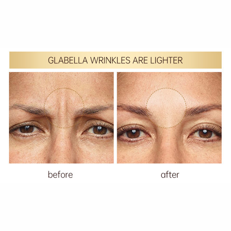 Retinol Facial Toner for Youthful Skin