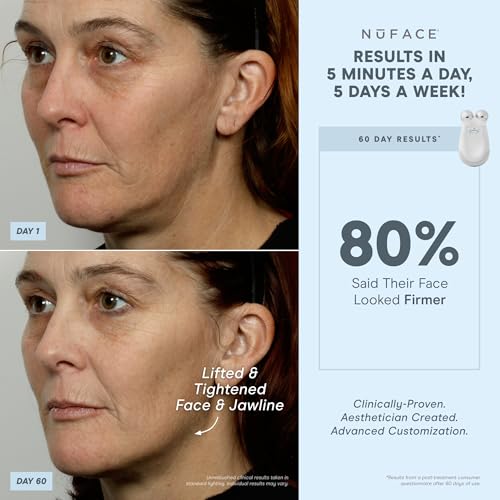 NuFACE Trinity Kit – Tone, Smooth, and Lift Skin