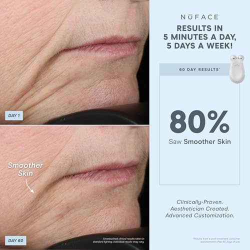 NuFACE Trinity Kit – Tone, Smooth, and Lift Skin