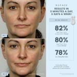 NuFACE Trinity Facial Toning Device Starter Kit