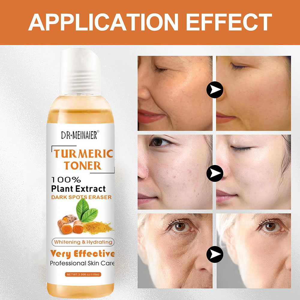 Turmeric Dark Spot Toner - 2 Pack