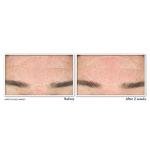 RoC Retinol Deep Wrinkle Serum Cleanser Duo