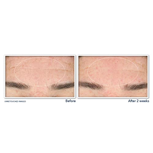 RoC Retinol Deep Wrinkle Serum Cleanser Duo