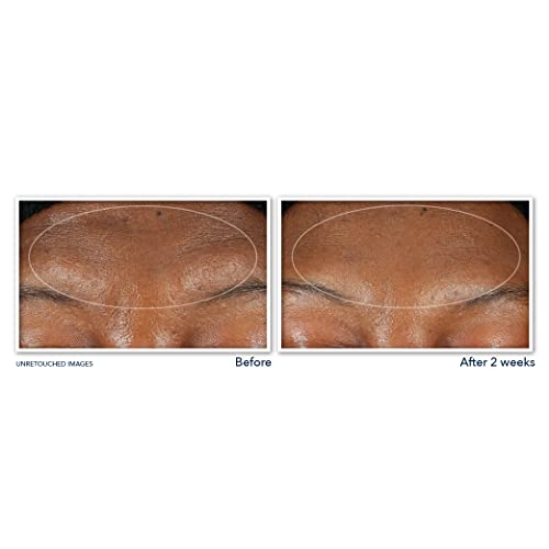 RoC Retinol Deep Wrinkle Serum Cleanser Duo
