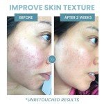 Peptide Anti-Aging Face Serum with Hyaluronic Acid