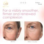 Potent Retinol Serum with Hyaluronic Acid & Vitamin C