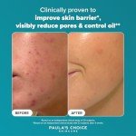 Paula's Choice 2% BHA Exfoliant for Smooth Skin