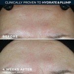 RoC Multi Correxion Hyaluronic Acid Face Moisturizer