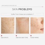 LAIKOU Pro Nicotinamide Skincare Set for All Skin Types