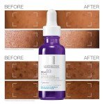 La Roche-Posay Anti-Aging Serum for Dark Spots