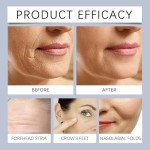 Olavita Anti-Aging Boto-x Serum for All Skin Types