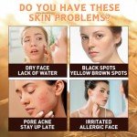 Rice Cream Moisturizer with Niacinamide for Radiant Skin