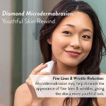 Diamond Microdermabrasion System for Youthful Skin