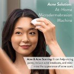 Diamond Microdermabrasion System for Youthful Skin