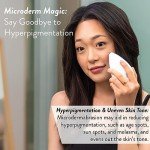 Diamond Microdermabrasion System for Youthful Skin