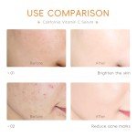 LAIKOU Vitamin C Serum for Brightening & Anti-Aging