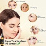 Retinol Serum with Hyaluronic Acid and Vitamin E