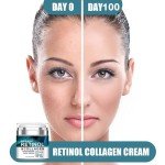 Retinol Anti-Wrinkle Cream with Hyaluronic Acid