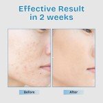 Brightening Vitamin Serum with Niacinamide & Antioxidants