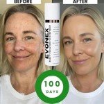 Evonex Age-Defying Tinted Moisturizer Foundation