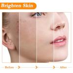 Wimony Vitamin C Anti-Aging Skin Care Set