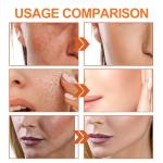 Vitamin C Skincare Set for Brightening and Anti-Aging